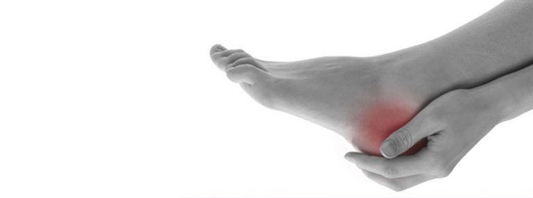 Achille Tendinopathy